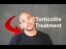 torticollis